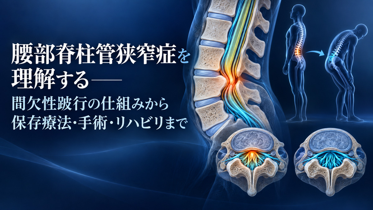 腰部脊柱管狭窄症を理解する――間欠性跛行の仕組みから保存療法・手術・リハビリまでのタイトル入りアイキャッチ
